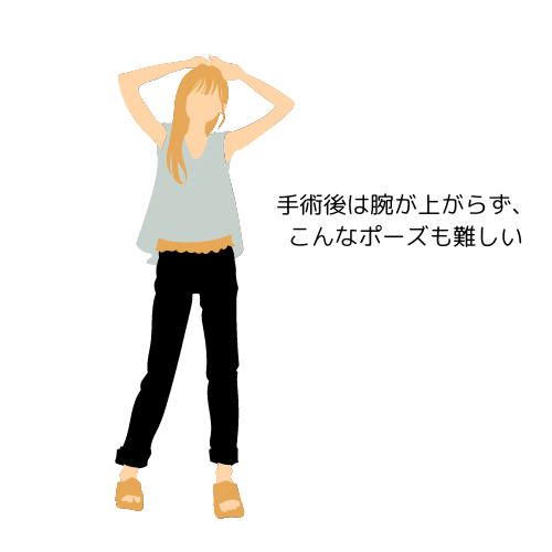 副乳がん手術とリンパ郭清のリハビリ経過