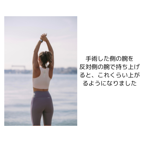 副乳がん手術とリンパ郭清のリハビリ経過